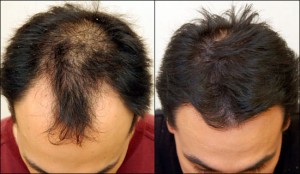 Biotin от 21st Century се грижи за Вашата коса, предпазва от косопад.