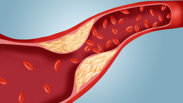 Bioactive Quercetin EMIQ на Natural Factors намалява холестерола и поддържа сърдечното здраве