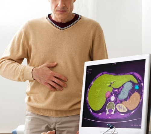 Екстракт от млечен бодил от Natural Factors на топ цена облекчава симптомите при чернодробни заболявания