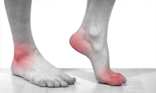 Череша Супер Концентрат 500 мг от Natural Factors на топ цена намалява риска от появата на подагра