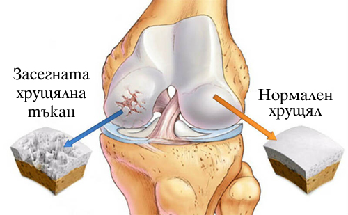 Колаген 500 мг с Л-лизин и Витамин C 120 таблетки от Webber Naturals на чудесна цена предпазва от дегенеративни ставни заболявания