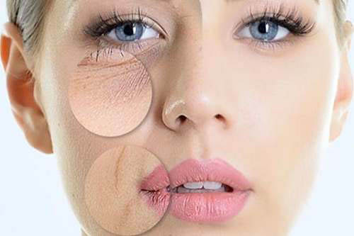 Collagen Types 1 and 3 Powder 200 gr от Doctor`s Best на топ цена подобрява еластичността на кожата и предпазва от появата на бръчки