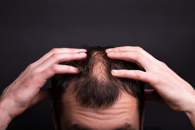 Minoxidil 5% пяна за мъже с миноксидил 177 мл на топ цена от Foligain стимулира повторния растеж на косата при косопад.