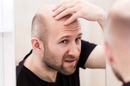 Advanced Styling Gel with 5% Minoxidil 60 мл на топ цена от Foligain спира оплешивяването при мъжете